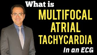 Wandering atrial pacemaker Multifocal Atrial Tachycardia MAT ECG Lectures Treatment USMLE [upl. by Chaing]