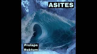 Asites  Prolaps Rektum 2024 [upl. by Felipa]