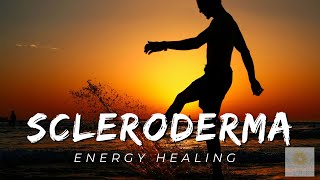 Scleroderma Energy Healing  Healing at Hand [upl. by Fairlie]