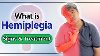 Hemiplegia  janiye kya hota hai hemiplegia  hemiplegia in hindi  hemiplegia treatment [upl. by Hgielac]