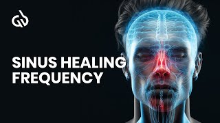 Nasal Polyps Frequency Sinus Frequency Sinus Healing Frequency [upl. by Eidson]