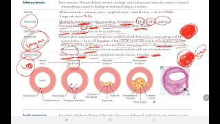 Arteriosclerosis 2  BACK BENCHERS ACADEMY [upl. by Leimaj]