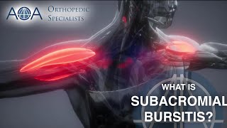 AOA Orthopedic Specialists  Subacromial Bursitis [upl. by Henri]