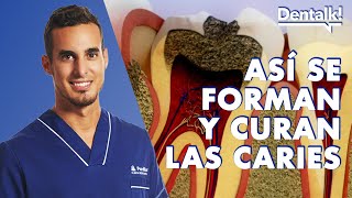 EVITA LAS CARIES – Causas PREVENCIÓN y tratamiento de la caries dental  Dentalk © [upl. by Stevenson242]