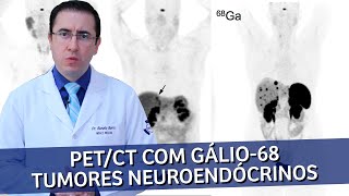 PET Scan com Gálio68 para Tumores Neuroendócrinos  IMEB [upl. by Hisbe]