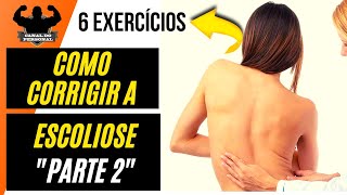 Como Corrigir a Escoliose  Exercícios para corrigir a ESCOLIOSE  PARTE 2 [upl. by Sikram271]