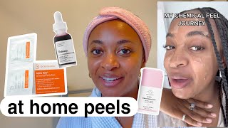 the best of at home chemical peels  safe for dark skin ✨ [upl. by Hollie]