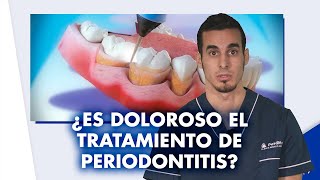 Tratamiento de la PERIODONTITIS  ¿Es doloroso ¿Cuánto vale  Shorts [upl. by Clo]