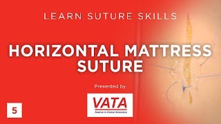 Horizontal Mattress Suture  Learn Suture Techniques  VATA [upl. by Vharat]