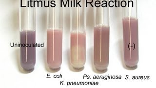 Litmus Milk Test  Amrita University [upl. by Nnaeerb]