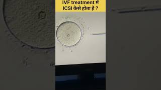 ICSI Procedure in IVF Intracytoplasmic sperm injection fertilitytreatment ivfjourney ivfsuccess [upl. by Toomay]