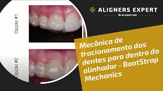 Mecânica de tracionamento dos dentes para dentro do alinhador  BootStrap Mechanics [upl. by Eenolem]