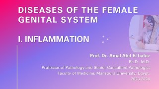 Inflammation of female genital tractشرح محاضرة [upl. by Acirtal751]