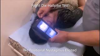 Augmented Right Half Hallpike Test [upl. by Victorie990]