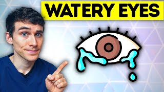 The 1 Best Watery Eyes Remedy causes and treatment  Eye Doctor Explains [upl. by Beore]