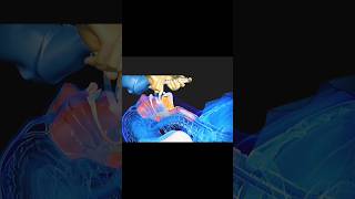 3d animation laryngeal mask airway insertion [upl. by Paderna]