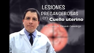 LESIONES EN CUELLO UTERINO POR QUE NO PAPANICOLAOU [upl. by Anul247]