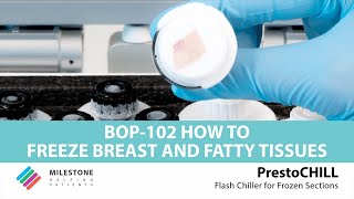 PrestoCHILL  BOP102  How to freeze breast and fatty tissues [upl. by Jaquiss]