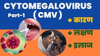 Cytomegalovirus  CMV  Positive l कारण । लक्षण । और इलाज l Part1 [upl. by Airotnahs8]