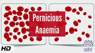 Pernicious Anemia Causes Signs and Symptoms Diagnosis and Treatment [upl. by Madonna]