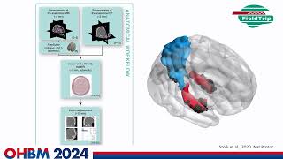 OHBM 2024  Oral Session  Xiao Chen  Intracranial neurophysiological mechanisms underlying rumi… [upl. by Fulcher]