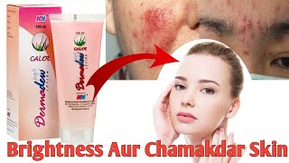 Dermadew Caloe Lotion hindi Review Iska Kam Kya Hai Side Effects Uses  benefits digitalmedilife [upl. by Chapen]