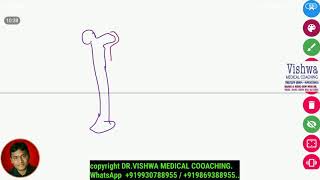 osteomyelitis pathology digital whiteboard sequestrum involucrum BY DRVISHWA MEDICAL 919930788955 [upl. by Gant]