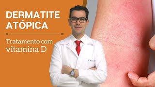 Tratamento de dermatite atopica com vitamina D [upl. by Bondon]