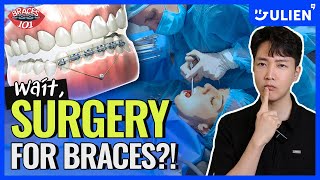 Surprising Surgeries They Do for Braces 😱 [upl. by Virnelli]