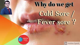 Cold Sores  Why  Fever Blisters [upl. by Salomo]