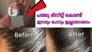 How to remove lice and nit easily  പത്തു മിനിറ്റ് കൊണ്ട് ഈരും പേനും ഇല്ലാതാക്കാംHow to remove lice [upl. by Lleirbag]