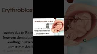 Erythroblastosis fetalis biology ncert bloodgroup shorts bodyfluids bloodpressure rhfactor [upl. by Olav]