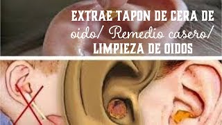 ELIMINA TAPÓN DE CERA EN OÍDOS LIMPIEZA DE OREJAS CON AGUA OXIGENADA PARA CURAR HERIDAS [upl. by Anilegna]