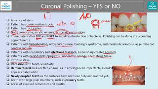 Indications and Contraindications for Coronal Polishing StudentRDH [upl. by Edveh]