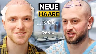 Tobi und Danil wagen den Schritt zur Haartransplantation Stammzellen  Erfahrung [upl. by Mcclary]