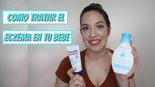 COMO TRATAR EL ECZEMA EN TU BEBE👶🏻 2021 HOW TO TREAT THE ECZEMA ON YOUR BABYS SKIN👶🏻 2021 [upl. by Beffrey437]