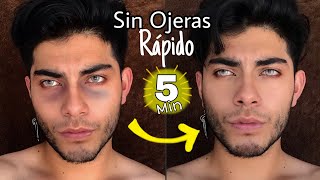 Cómo quitar ojeras Rápido 🌿😱 ReyvajMiran [upl. by Lita483]