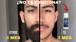 ¡POR ESTAS RAZONES NO TE CRECE BARBA AL USAR MINOXIDIL [upl. by Zita]