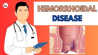 Hemorrhoidal Disease Causes Symptoms and Treatment  Sandhya Raman Adhar Foundation [upl. by Beaner603]