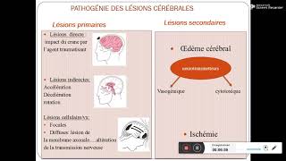 Traumatisme cranien Pr Daoud [upl. by Ennazor680]