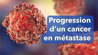 Cancer en progression  mécanisme dune métastase [upl. by Elleyoj232]