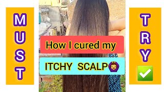 Scalp itching home remedy  Scalp itching treatment [upl. by Seravart]