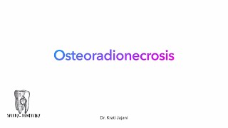 Osteo radio necrosis  the bone  the radiotherapy and the damage omfs mds cancer neetmds [upl. by Bierman509]