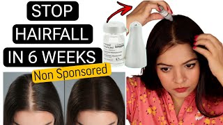 HOW I STOPPED MY HAIRFALL IN 6 WEEKS  LOREAL AMINEXIL HAIR SERUM REVIEW  HAIRFALL TREATMENT [upl. by Dare958]