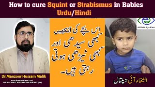 How to cure Squint or Strabismus in Babies  Urdu Hindi [upl. by Ilrebma]