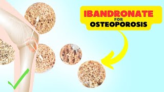 Ibandronate Sodium Supporting Bone Health and Osteoporosis Prevention [upl. by Alrzc388]