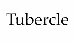 How to Pronounce Tubercle [upl. by Cilo]