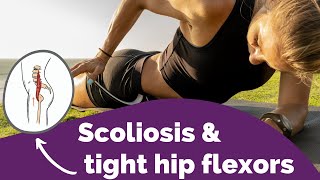 Scoliosis and Tight Hip Flexors  How a Tight Iliopsoas Curves the Spine [upl. by Kentiggerma950]