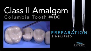 Amalgam Simplified Preparation  Columbia 4 DO  Two Burs Only [upl. by Enelear]