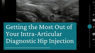 10 Tips for Getting the Most Out of Your IntraArticular Diagnostic Hip Injection [upl. by Karry]